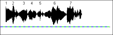 Sound Effets Pause 0s